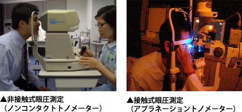 眼圧検査