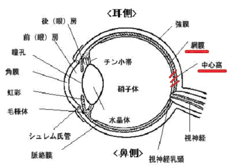 中心性视网膜病变