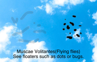 muscae volitantes