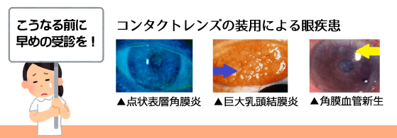 こうなる前に早めの受診を！