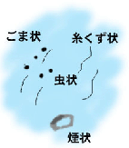 飛蚊症