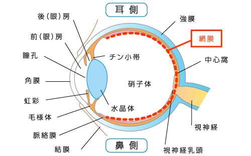 網膜格子状変性