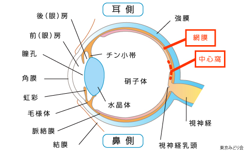 黄斑円孔