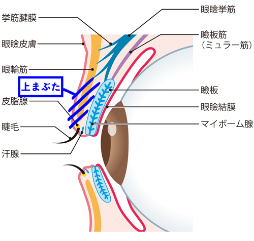 眼瞼下垂