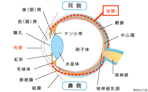 強膜炎・上強膜炎