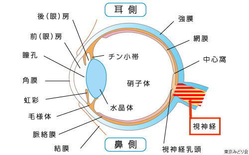 視神経炎