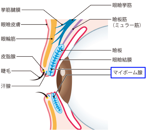 マイボーム腺梗塞