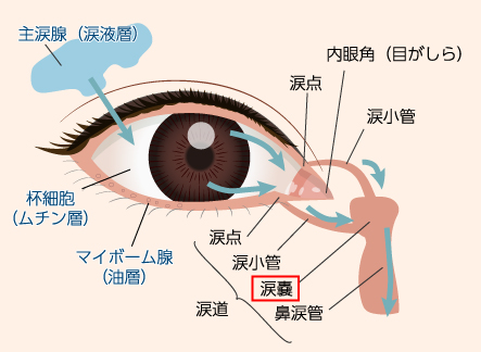 涙嚢炎