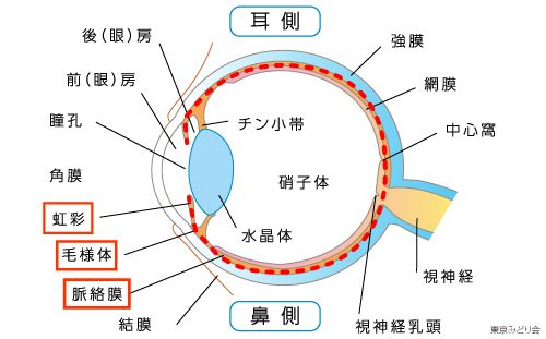 ぶどう膜炎