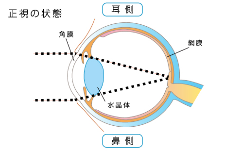 正視の状態