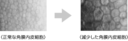 角膜内皮細胞