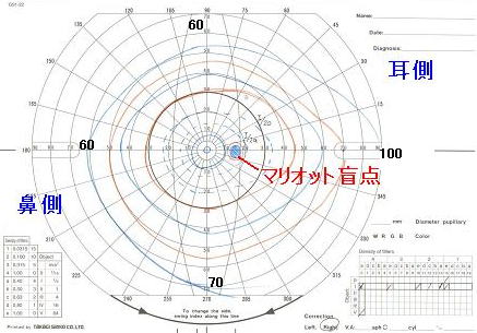 視野検査