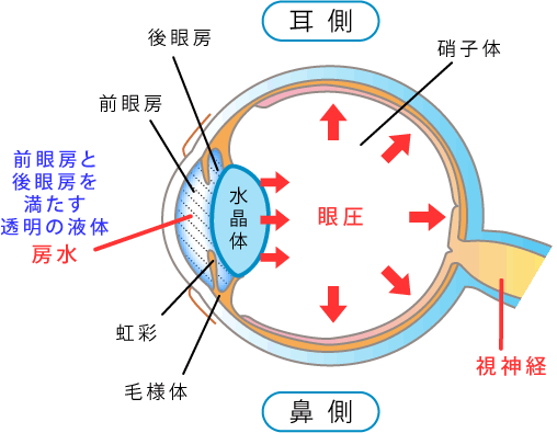 緑内障の原因/図