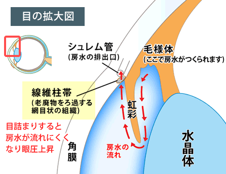 線維柱帯の目詰まり